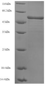 Sarcoplasmic/endoplasmic reticulum calcium ATPase 2 (ATP2A2), partial, human, recombinant