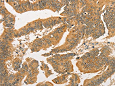 Anti-BCL2L14
