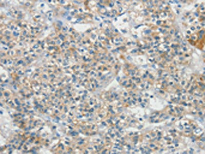 Anti-SCN9A