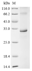 E3 ubiquitin-protein ligase MARCH5 (Marchf5), mouse, recombinant