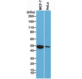 Anti-Cytokeratin 18, clone RM279 (recombinant antibody)