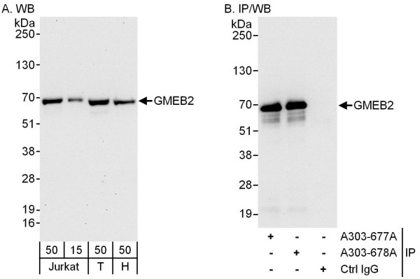 Anti-GMEB2