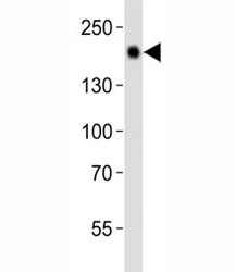 Anti-Egfr