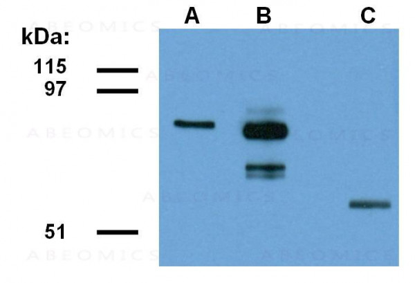 Anti-ABRA1 Monoclonal Antibody (Clone:ABRA1-01)