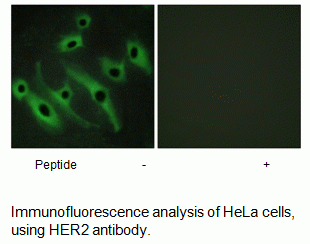 Anti-HER2