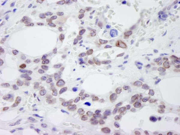 Anti-NUP214 (IHC)