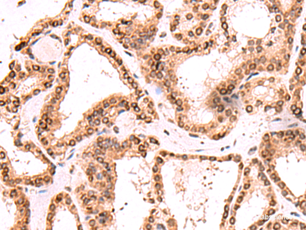 Anti-TOR1AIP1