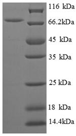 Biosynthetic arginine decarboxylase (speA), partial, Escherichia coli, recombinant