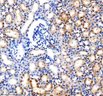 Anti-MINPP1 / Multiple inositol polyphosphate phosphatase 1