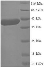 Alpha N-terminal protein methyltransferase 1A (METTL11A), human, recombinant