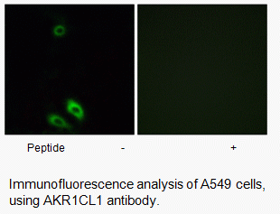 Anti-AKR1CL1