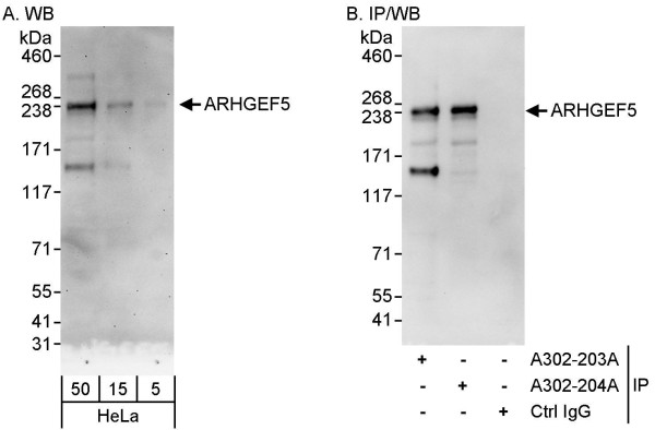 Anti-ARHGEF5