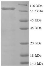 Bifunctional heparan sulfate N-deacetylase/N-sulfotransferase 1 (NDST1), partial, human, recombinant
