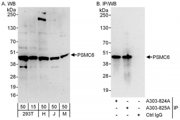 Anti-PSMC6