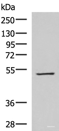 Anti-FDXR