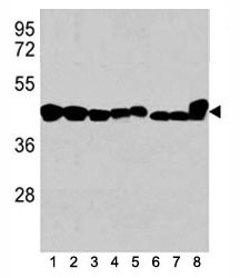 Anti-b-Actin, clone 137CT26.1.1
