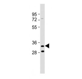 Anti-TMEM106B (C-Terminal Region)
