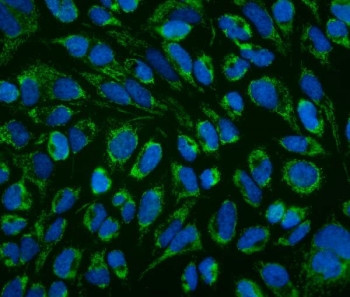 Anti-LRPPRC Antibody / GP130