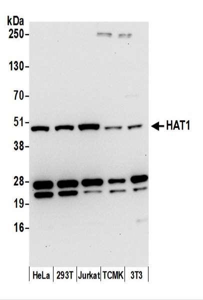 Anti-HAT1/KAT1