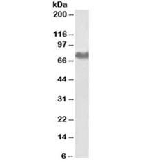 Anti-Fibrinogen