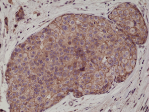 Anti-E-Cadherin (human), Rabbit Monoclonal (RM244)