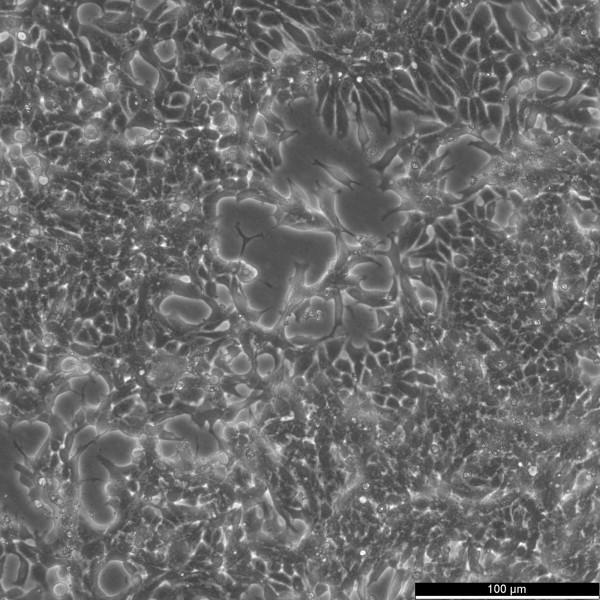 22RV1 Cells