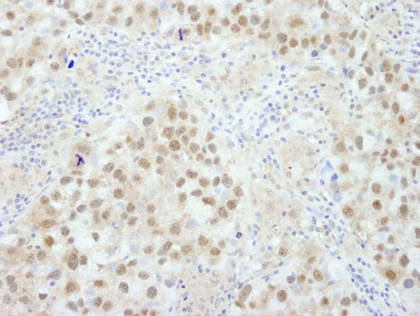 Anti-BRCA1 (IHC)