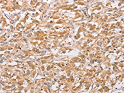 Anti-CSGALNACT2