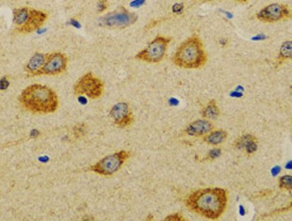 Anti-NEU1 / Neuraminidase