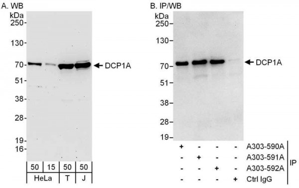 Anti-DCP1A