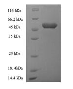 Acyl-CoA-binding domain-containing protein 4 (ACBD4), human, recombinant