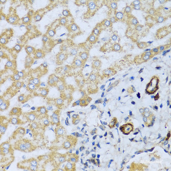 Anti-CSH1