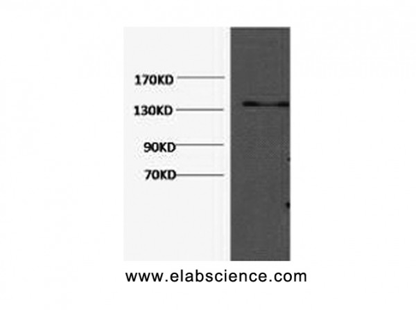 Anti-COL3A1, clone 5G2
