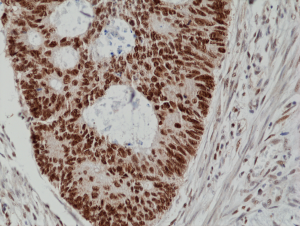 Anti-MSH2 (human), Rabbit Monoclonal (RM375)