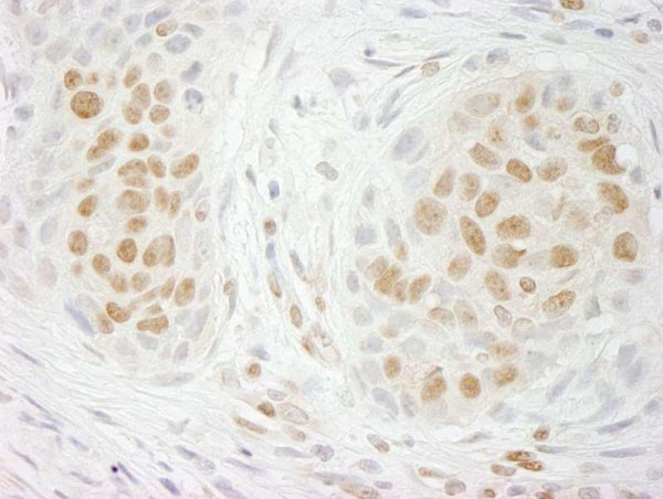 Anti-GIT2 (IHC)