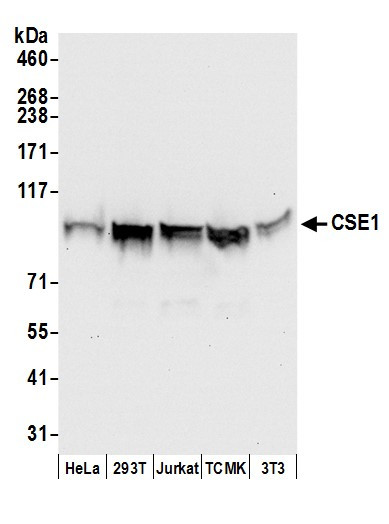 Anti-CSE1