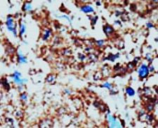 Anti-EphB1