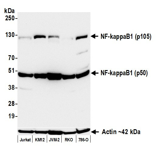 Anti-NF-kappaB1 (p105/p50) Recombinant Monoclonal