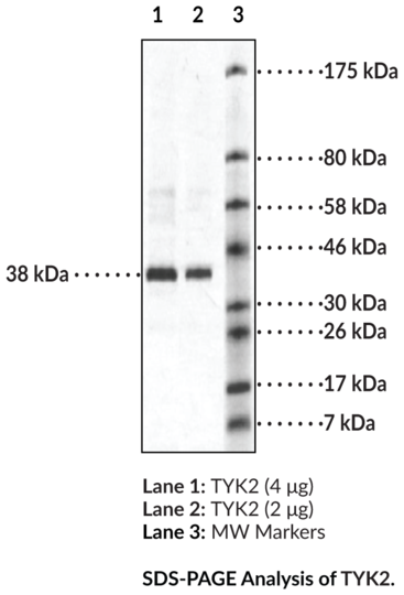 TYK2 (human, recombinant)
