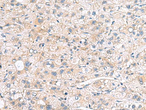 Anti-MYL1