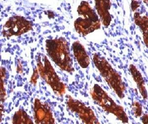 Anti-TG / Thyroglobulin, clone 2H11