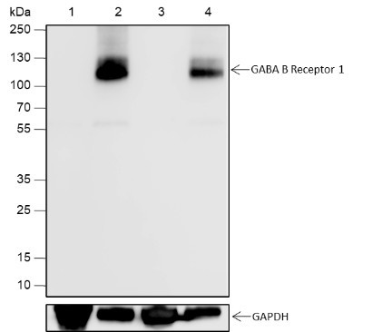 Anti-Recombinant GABA B Receptor 1, clone A650