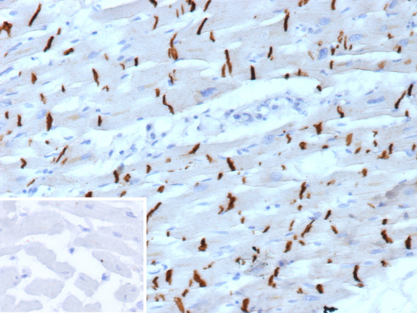 Anti-N-Cadherin / Cadherin-2 / CD325 (NCAD), clone CDH2/9488