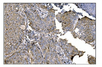 Anti-OAT / Ornithine aminotransferase