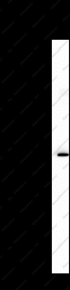 Anti-Recombinant MMP-1, clone C311772
