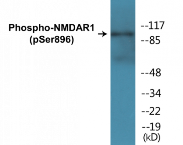 NMDAR1 (Phospho-Ser896) Colorimetric Cell-Based ELISA Kit