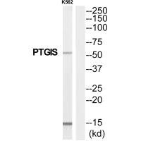 Anti-PTGIS