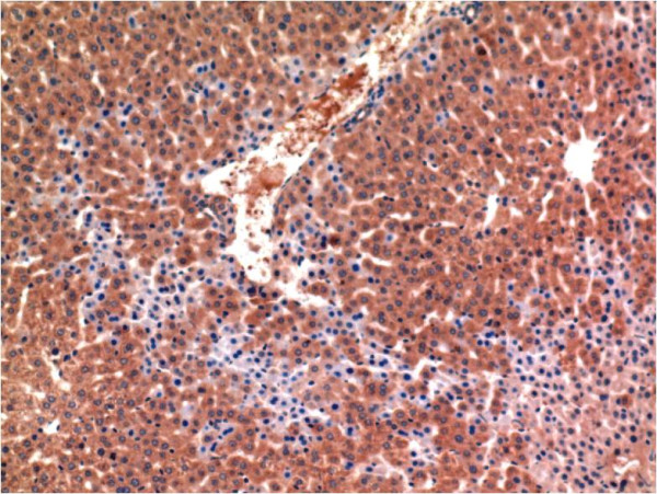 Anti-CASP3