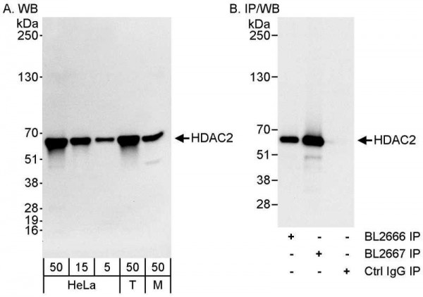 Anti-HDAC2