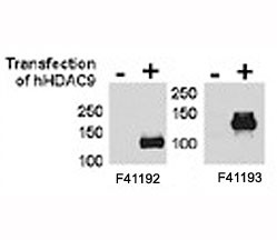 Anti-HDAC9